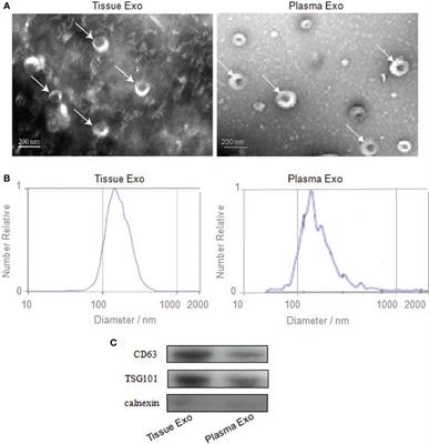 Proteomics-Based Identification of Candidate Exosomal Glycoprotein Biomarkers and Their Value for Diagnosing Colorectal Cancer